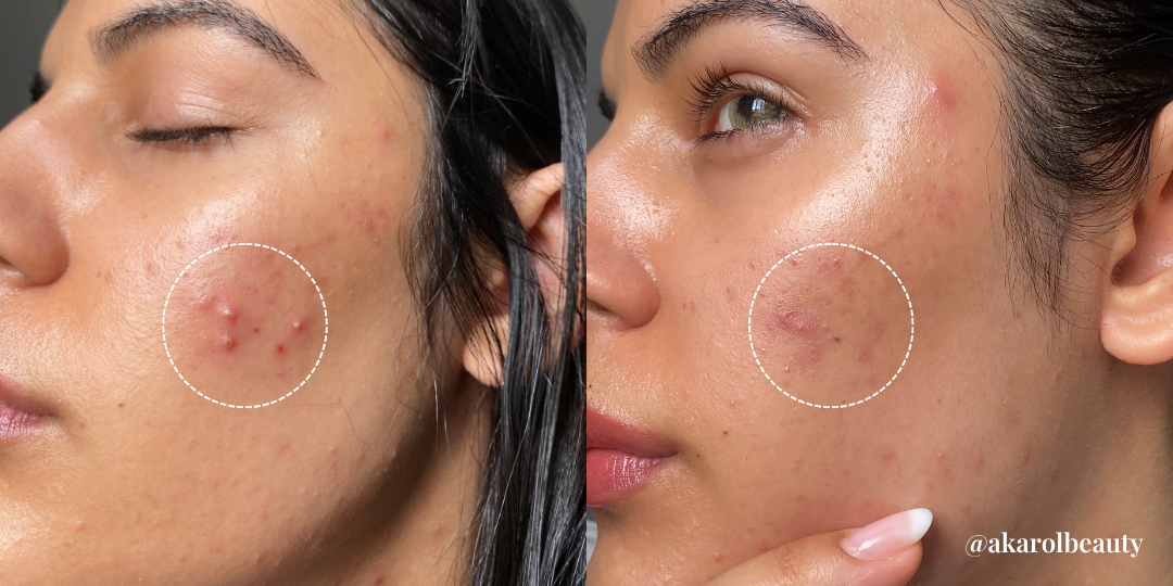 Antes 1.png__PID:b44a21a1-3ff5-4a2f-adf2-2c16bb9f3397