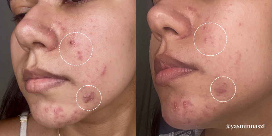 Antes 2.png__PID:4a21a13f-f56a-4f6d-b22c-16bb9f339796