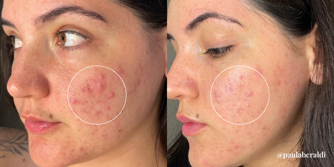 Antes 3.png__PID:21a13ff5-6a2f-4df2-ac16-bb9f33979645